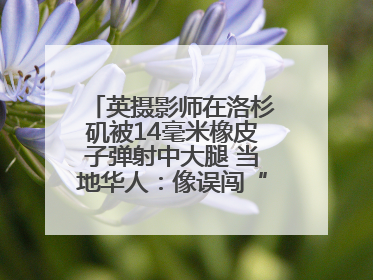英摄影师在洛杉矶被14毫米橡皮子弹射中大腿 当地华人：像误闯“末日生存”游戏